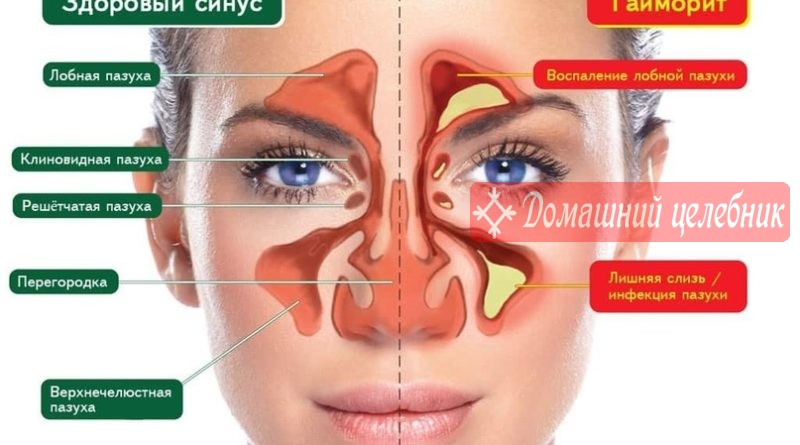 Опасная слизь в организме. Признаки скопления и как избавиться