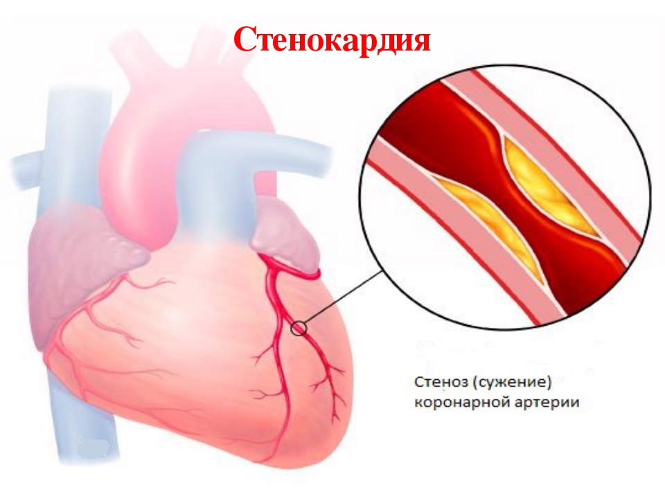 Похожее изображение